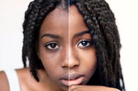 Soin Visage Traitement des Taches :